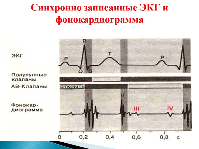 Синхронно записанные ЭКГ и фонокардиограмма